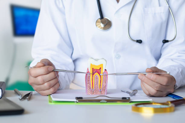 Best Emergency Wisdom Tooth Extraction in Asbury, IA